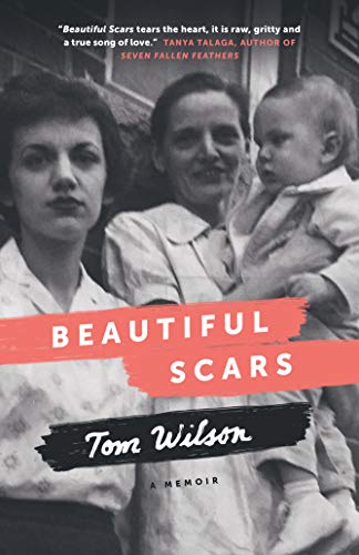 Beautiful Scars: A Memoir