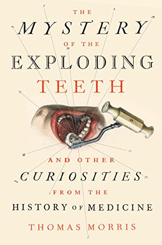 The Mystery of the Exploding Teeth And Other Curiosities from the History of Medicine